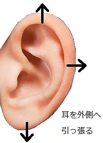 耳を引っ張る治療方法の説明画像